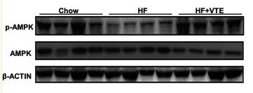 AMPK alpha Antibody - FIGURE 6
VTE ameliorating NASH involves AMPK-LXRα signaling activation.