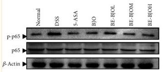NF-kB p65 Antibody - Figure 6
BE-BJO inhibited the activation of the NF-κB signaling pathway.