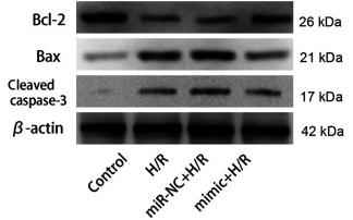 Bcl-2 Antibody - Figure 4
miR-590-3p inhibits autophagy- and apoptosis-associated protein expression levels in H/R-treated cardiomyocytes.