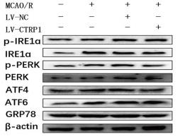PERK Antibody - FIGURE 5
CTRP1 inhibited ERS via PERK signal pathway in the cortex of MCAO/R-treated rats.