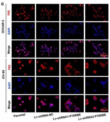 NF-kB p65 Antibody - Figure 5.