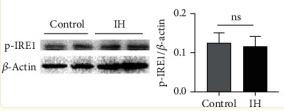 Phospho-IRE1 (Ser724) Antibody - Figure 1
The PERK pathway but not the ATF-6 or IRE-1 pathway was activated.