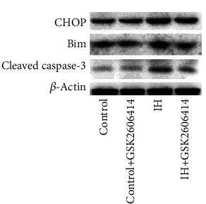 DDIT3/CHOP Antibody - Figure 3
GSK2606414 reduced the activation of caspase-3 via mitochondria-dependent apoptosis.