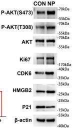 Phospho-AKT1/2/3 (Ser473) Antibody - Fig.