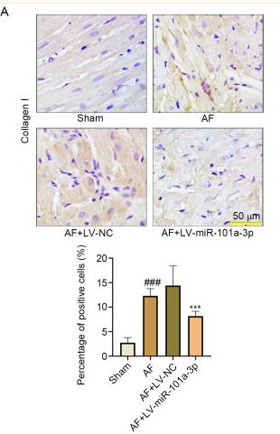 Collagen I Antibody - Figure 4.