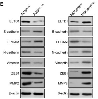 MMP2 Antibody - Figure 3
ELTD1 Facilitates EMT of GC Cells.