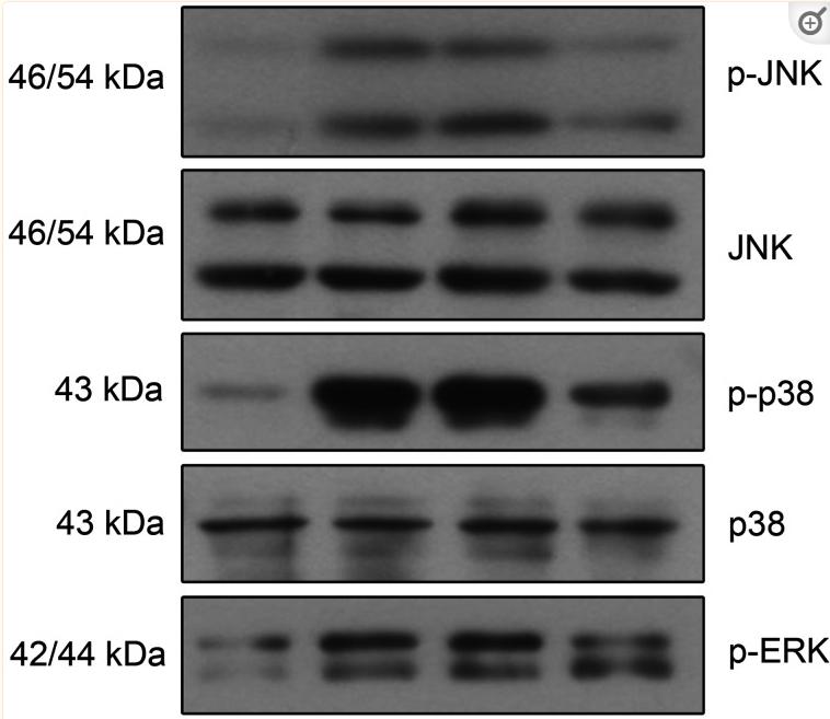 Phospho-JNK1/2/3 (Thr183+Tyr185) Antibody - Fig.