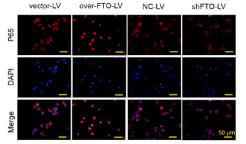 NF-kB p65 Antibody - Fig.