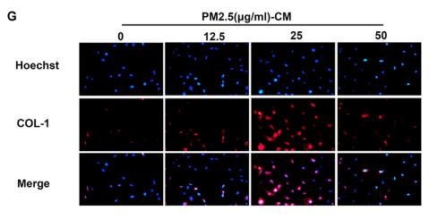 Collagen I Antibody - Fig.