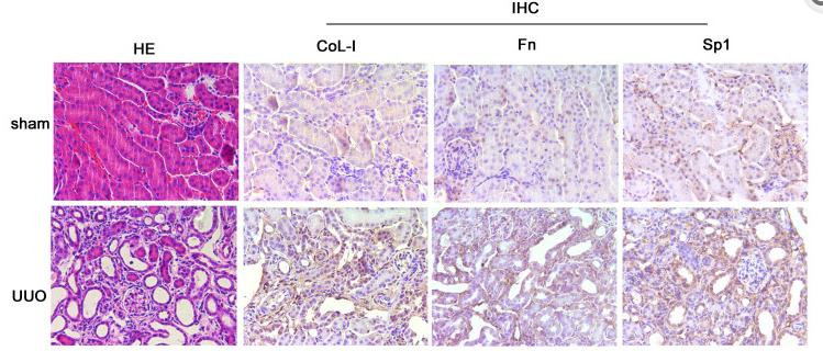 Collagen I Antibody - Figure 1
The expression levels of Sp1 in UUO kidneys.