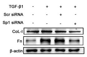 Collagen I Antibody - Figure 3
The knockdown of Sp1 inhibited TGF-β1-induced ECM expression.