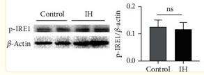 Phospho-IRE1 (Ser724) Antibody - Figure 1
The PERK pathway but not the ATF-6 or IRE-1 pathway was activated.