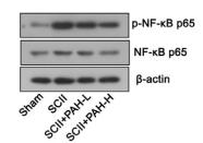 NF-kB p65 Antibody - Fig.