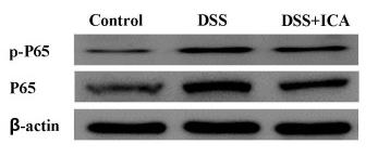 NF-kB p65 Antibody - Figure 4.