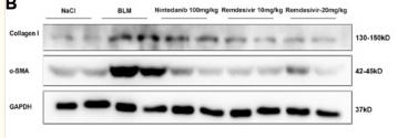 Collagen I Antibody - FIGURE 9
Remdesivir attenuates BLM-induced fibroblast activation and epithelial injury in vivo (A) RT-PCR was performed to detect mRNA levels of α-SMA, Fibronectin and Collagen I in lung tissues.
