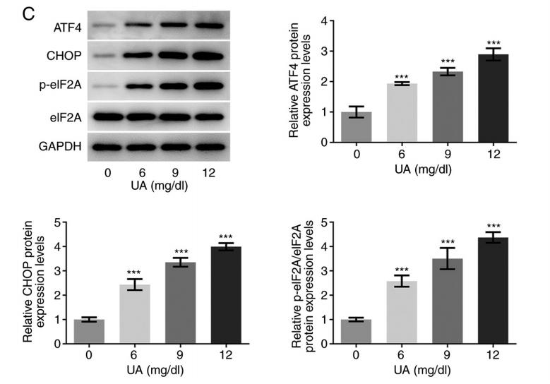 DDIT3/CHOP Antibody - Figure 1.