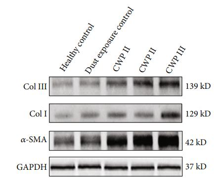 Collagen III Antibody - Figure 2:| Relative expression level of fibrosis-related proteins by western blot analysis.