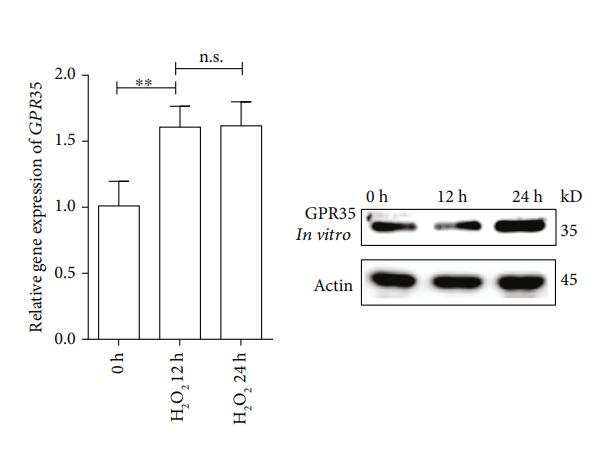 beta-Actin Antibody - Figure 5:| ROS causes a positive feedback loop of GPR35 upregulation.
