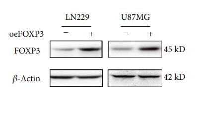 beta Actin Antibody - Figure 8:| Experimental verification reveals FOXP3 involved in TMZ resistance (a).