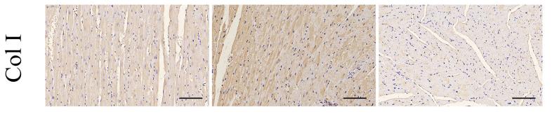 Collagen I Antibody - FIGURE 3 | Effects of sleeve gastrectomy (SG) on diabetic-induced cardiac remodeling.