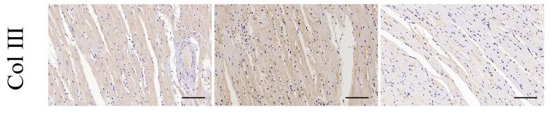 Collagen III Antibody - FIGURE 3 | Effects of sleeve gastrectomy (SG) on diabetic-induced cardiac remodeling.