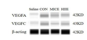 VEGFA Antibody - Figure 4.