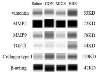 TGF beta 1 Antibody - Figure 5.