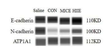 E-cadherin Antibody - Figure 5.