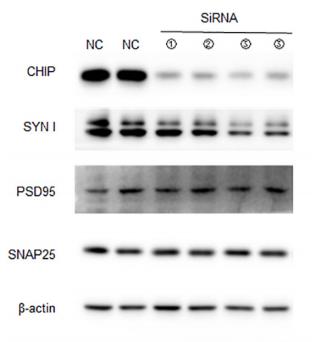 beta Actin Antibody - FIGURE 6 | Decreased CHIP expression altered synaptic protein expression and phosphorylation in N2a cells.