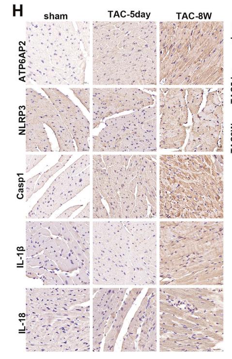 IL1 beta Antibody - Fig.