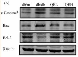 Bcl-2 Antibody - Figure 2
Quercetin inhibited cell apoptosis in the pancreas of T2DM mice

(A) Bands of c-Caspase3, Bax, and Bcl-2 by western blotting in the pancreas of mice.