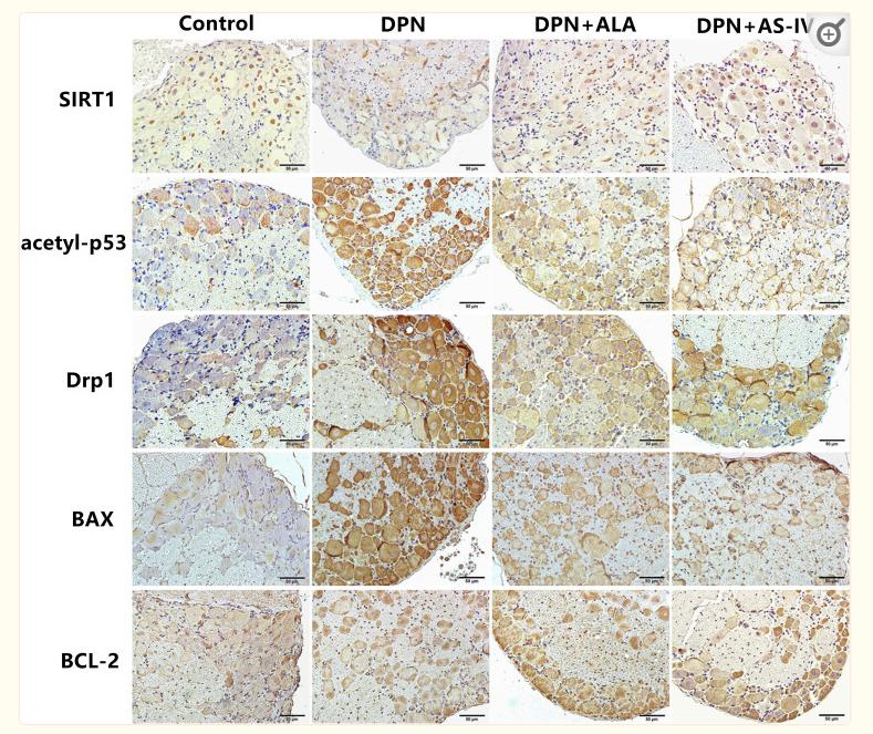 Bcl-2 Antibody - Figure 9
Immunohistochemical staining of SIRT1, acetyl-p53, Drp1, BAX, BCL-2.