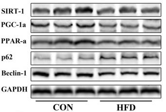 SQSTM1/p62 Antibody - Fig.