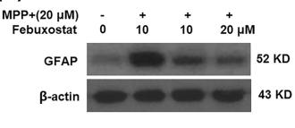 GFAP Antibody - Fig.