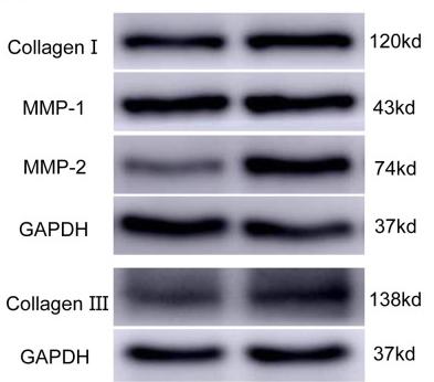 Collagen I Antibody - Figure 2
BMSC-CM promoted collagen production in fibroblasts.