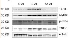 Tubulin alpha Antibody - Figure 3
Ac-SDKP reduces lung inflammation and activation of TLR4 signaling in rats exposed to silica.