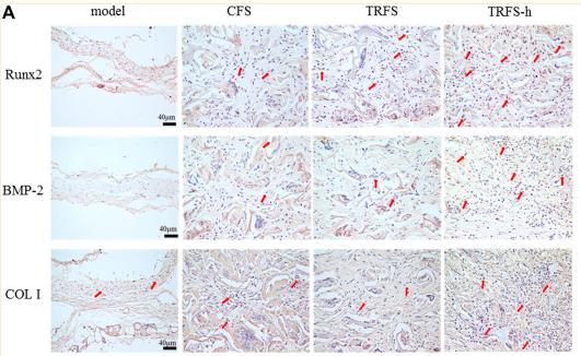 Collagen I Antibody - FIGURE 4
Osteogenesis-associated protein immunohistochemical staining was performed in skull tissue sections at 12 weeks post-surgery (A) Immunohistochemical staining of osteogenesis-associated proteins Runx2, BMP-2, and COL I.
