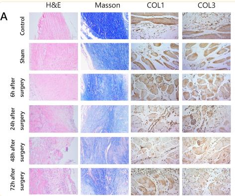 Collagen III Antibody - Fig.