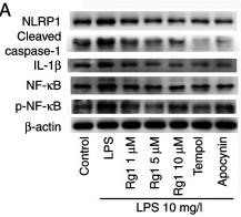 IL1 beta Antibody - Figure 4
Effects of Rg1 on the expression levels of NLRP1, cleaved-caspase-1, IL-1β, NF-κB and p-NF-κB in LPS-induced HT22 cells determined by western blotting.