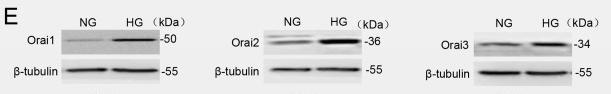 Tubulin alpha Antibody - Figure 1
Store-operated calcium entry (SOCE) activity and Orai1–3 protein expression levels are significantly increased in mouse aortic endothelial cells (MAECs) cultured in high glucose (HG) for 7 days and in thoracic aorta endothelial cells of streptozotocin (STZ)-induced mice with diabetes.