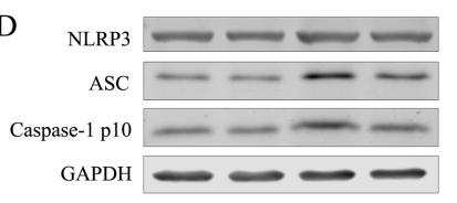 NLRP3 Antibody - Figure 4
RES inhibits NLRP3 inflammasome activation in the heart tissues of rats with AMI (n = 3 samples per group).
