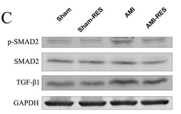 TGF beta 1 Antibody - Figure 5
RES inhibits the TGF-β.