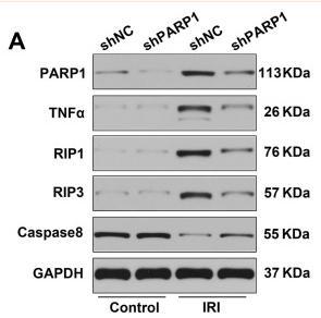 TNF alpha Antibody - Figure 6
PARP1 inhibitor attenuates renal ischemia-reperfusion injury.