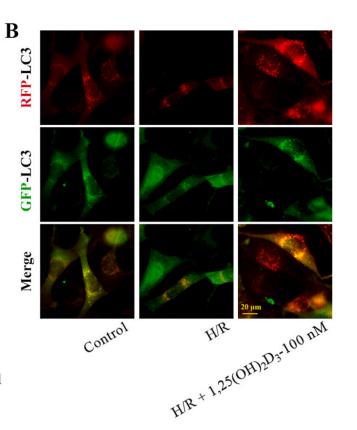 LC3A/B Antibody - Fig.