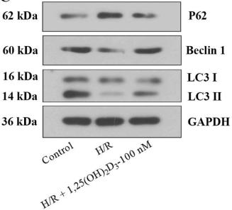 LC3A/B Antibody - Fig.