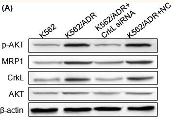 Phospho-AKT1/2/3 (Ser473) Antibody - FIGURE 3
SILENCING OF CRKL INHIBITED PI3K/AKT/MRP1 PATHWAY IN K562/ADR CELLS.