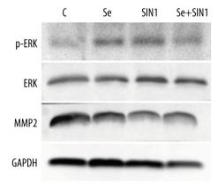 MMP2 Antibody - Figure 4
Expression of ERK and MMP2 in imDCs.