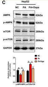 mTOR Antibody - FIGURE 5
Dapagliflozin induces autophagy via the AMPK-mTOR pathway in vitro and in vivo.