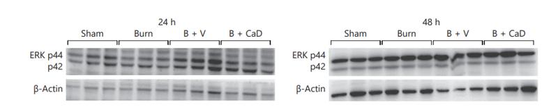 ERK1/2 Antibody - Fig.