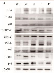 ERK1/2 Antibody - Figure 8
Inhibition of TLR4/MAPK/NF-κB signaling pathway.